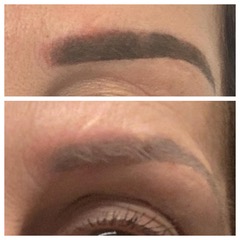 DETATOUAGE GENTLE FADE REMOVER NOVEMBRE 2025 – Image 5