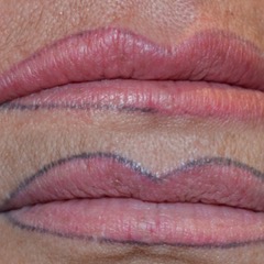 DETATOUAGE GENTLE FADE REMOVER NOVEMBRE 2025 – Image 4