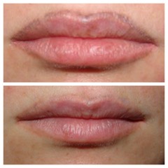 DETATOUAGE GENTLE FADE REMOVER NOVEMBRE 2025 – Image 2