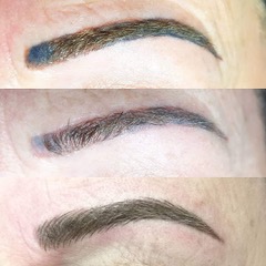 DETATOUAGE GENTLE FADE REMOVER NOVEMBRE 2025 – Image 3